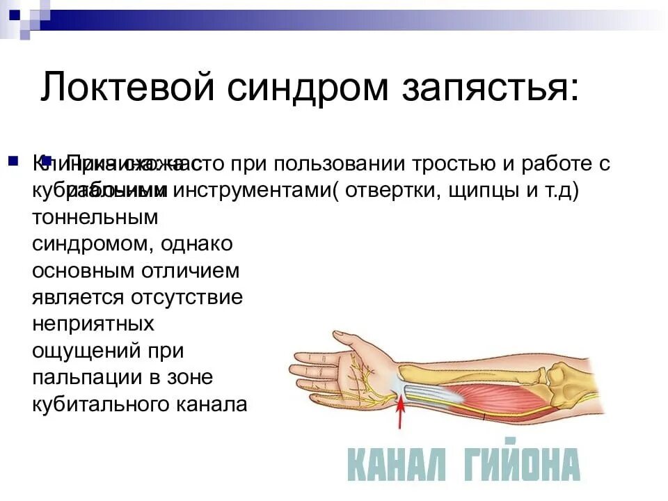 Нейропатия операция. Нейропатия локтевого нерва синдром. Сдавление лучевого нерва клиника. Локтевой нерв нейропати. Нейропатия локтевого нерва клиника.