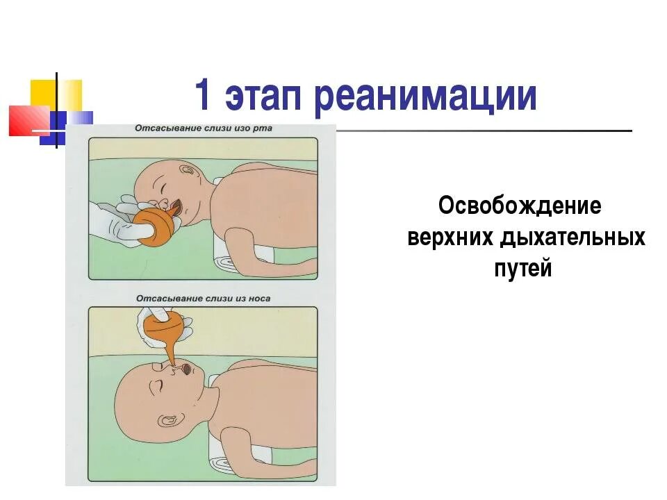 Реанимация новорожденных алгоритм