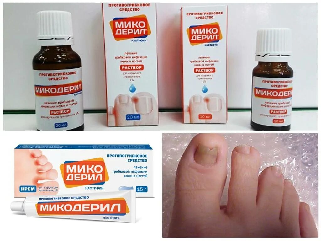 Грибок ногтей эффективное лечение отзывы. Микодерил мазь. Капли от грибка Микодерил. Средство от грибка ЕС ногтях. Лекарство от грибка ногтей на ногах.