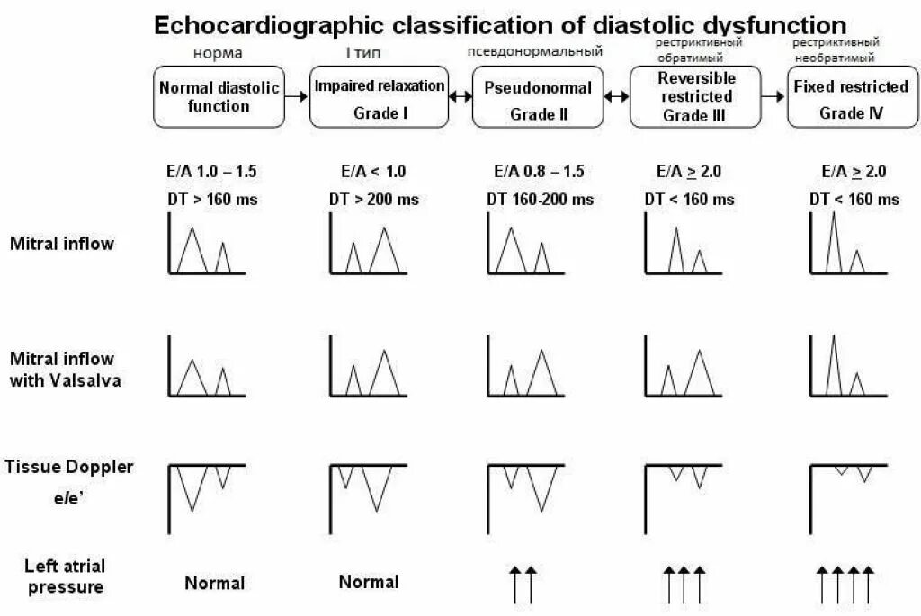 Степени диастолической дисфункции. Типы диастолической дисфункции ЭХОКГ. Диастолическая дисфункция левого желудочка 1 типа по ЭХОКГ. Типы диастолической дисфункции лж. Диастолическая дисфункция левого желудочка 2 типа что это такое.