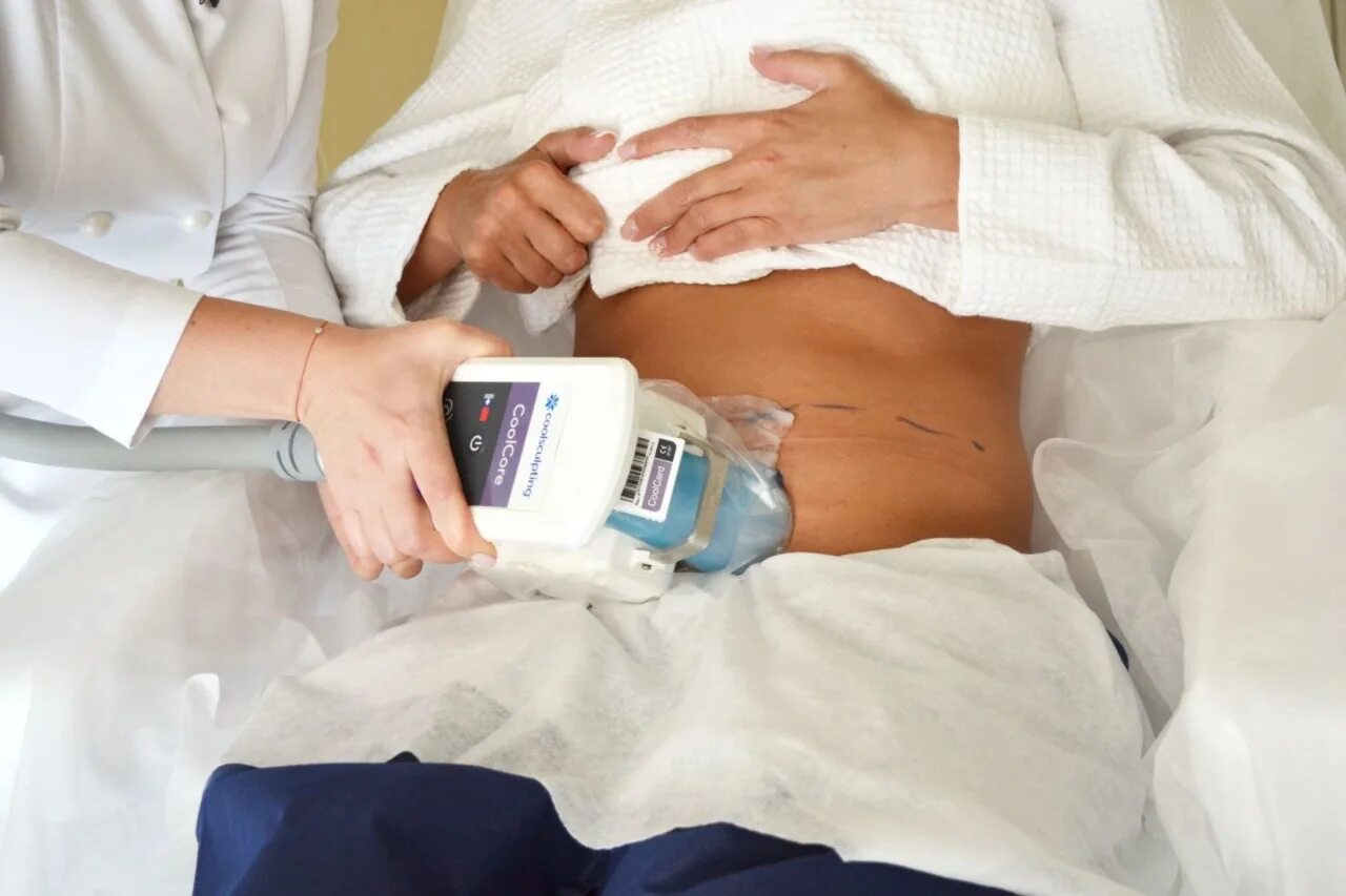 Заморозка живота. Zeltiq Зелтик. Аппарат Зелтик криолиполиз. Zeltiq COOLSCULPTING. Криолиполиз Зелтик COOLSCULPTING.