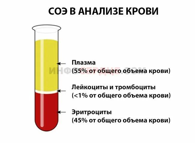 Что означает соэ в крови у мужчин. СОЭ. Скорость оседания эритроц. Определение СОЭ. СОЭ подписи к рисунку.