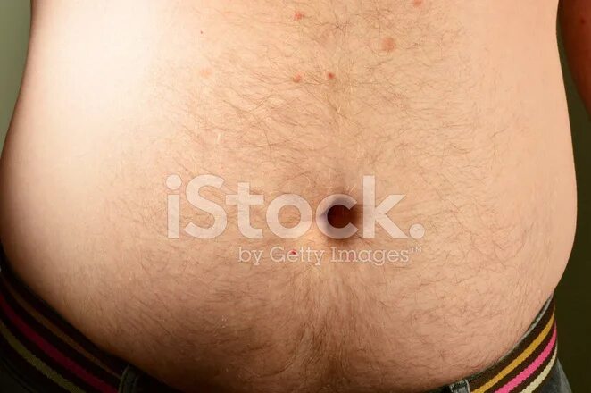 Женщина надорвала живот. Симптомы надорванного живота. Женщина надорвала живот. Женщина надорвала живот. Женщина надорвала живот.