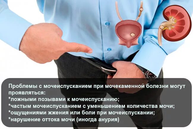 Боли при мочеиспускании у женщин чем лечить. Мочекаменная болезнь проблемы. мочеиспускание при мочекаменной болезни. боль при мочеиспускании. проблемы с мочеиспусканием.