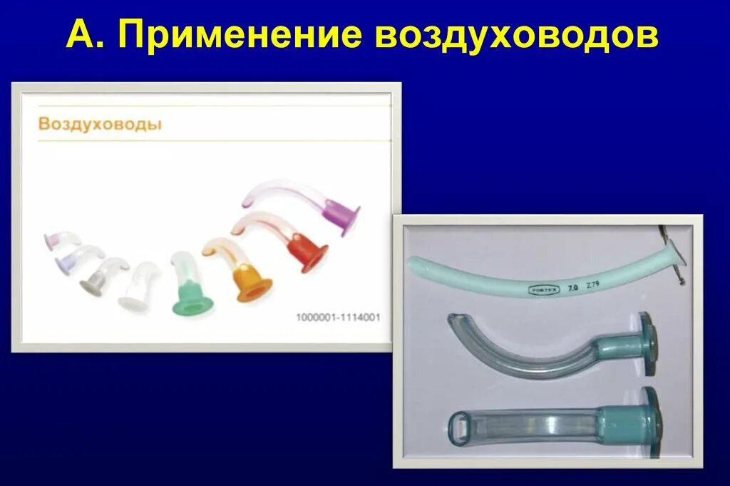Воздуховод алгоритм. Техника применения воздуховода. применение воздуховода в медицине. применение воздуховода алгоритм. введение воздуховода алгоритм.