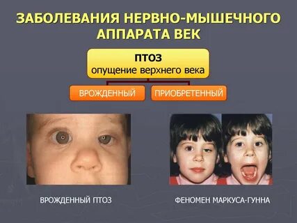 Синкенезия это