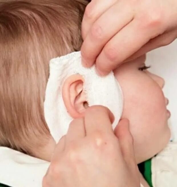 Ушной компресс на ухо ребенку. Чем можно закапывать уши ребенку