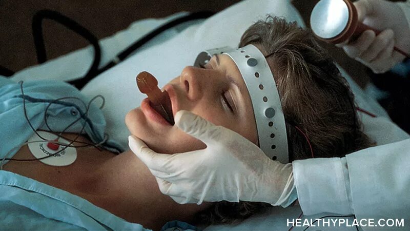 Колетро судорожная терапия. Электрошоковая терапия в психиатрии. Эст электросудорожная терапия. Электрошоковая терапия в психиатрии. Эст электросудорожная терапия.