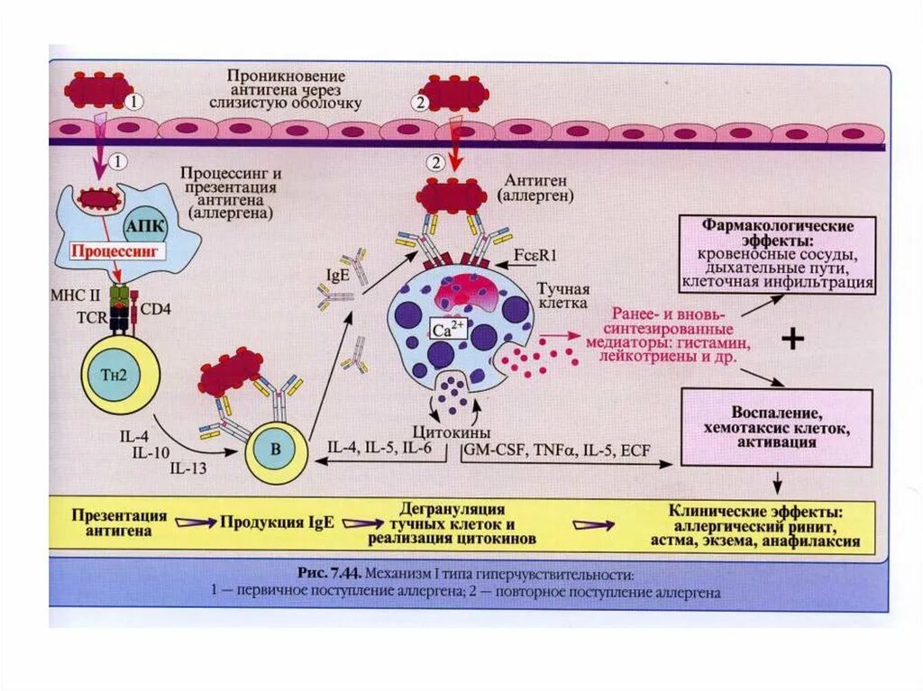 Анафилактический шок аллерген. Патогенез реакции гиперчувствительности 1 типа. Схема патогенеза реакции гиперчувствительности 1 типа. 3 Тип гиперчувствительности патофизиология. Схема аллергической реакции 3 типа.