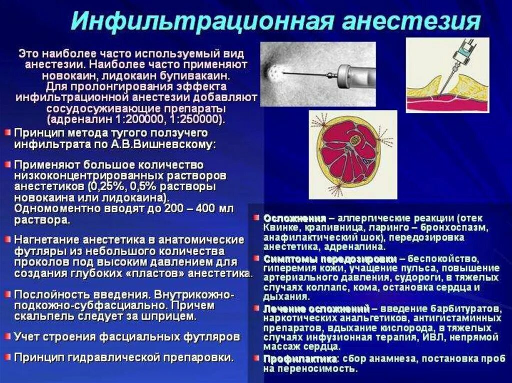 Анестезиология рекомендации. Инфильтрационная анестезия алгоритм. Инфильтрационная анестезия показания и осложнения. Показания к инфильтрационной анестезии в стоматологии. Преимущества анестезии по Вишневскому.