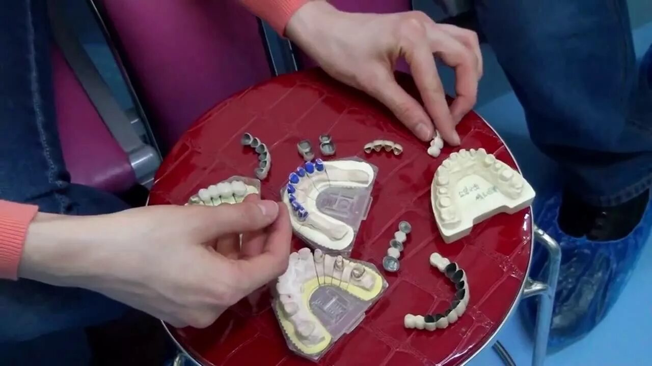 Сделать зубы в китае. Зубы протезирование китай. выставить зубы в китай.