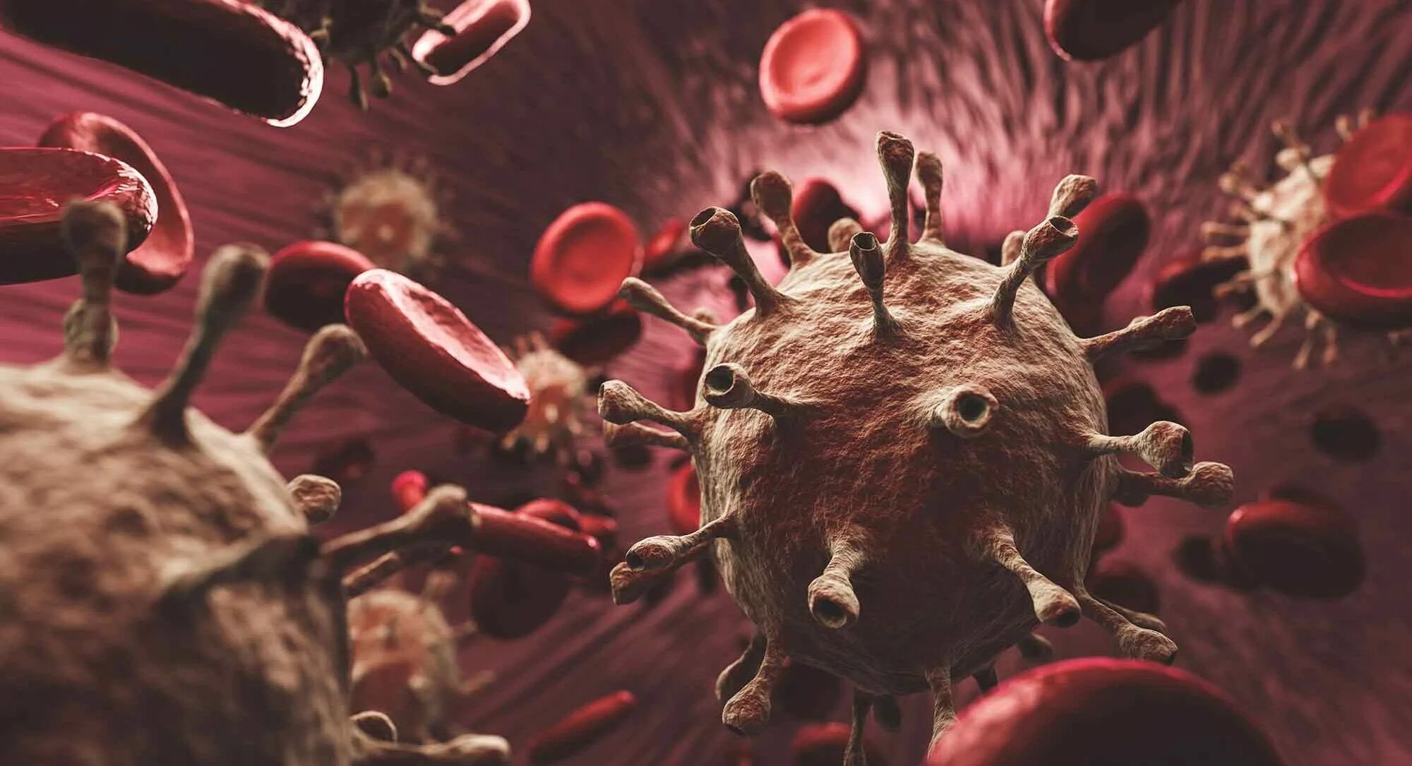 The is caused by a virus