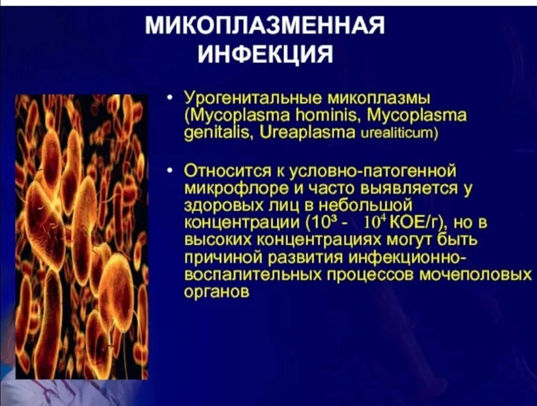 Микоплазменная инфекция мочеполовой системы. Микоплазменная инфекция Mycoplasma Hominis. Микоплазменная инфекция этиология. Урогенитальные заболевания, вызванные микоплазмами. Микоплазмоз у мужчин симптомы