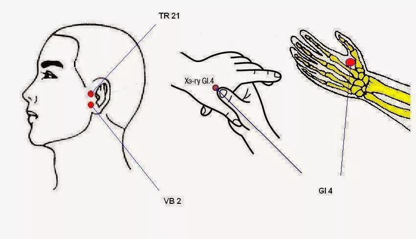 Точечный массаж ушной раковины. Самомассаж ушных раковин. Акупрессура точки при головной боли. Самомассаж уха. Массаж при отите.