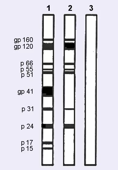 Иммуноблот на вич. Иммуноблот ВИЧ. Иммуноблот ВИЧ интерпретация результатов. ИФА И иммуноблоттинг. Иммуноблот ВИЧ результат.
