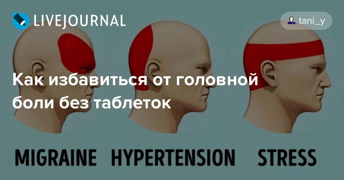 Боль в лобной доле. Избавление от болей головы. Головная боль без таблетки. Как избавиться от головной боли. Болит голова в лобной части.