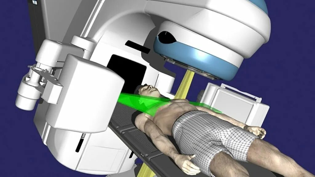 Трехмерная конформная лучевая терапия. IGRT лучевая терапия. Трехмерная конформная лучевая терапия (3d-CRT). Гамма излучение лучевая терапия. Длт в онкологии