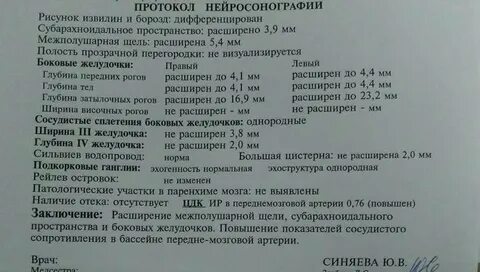 Что такое нейросонография