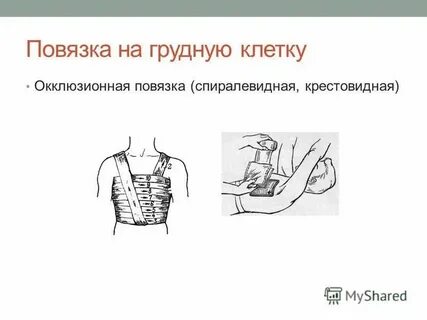 Окклюзионная повязка при каком ранении