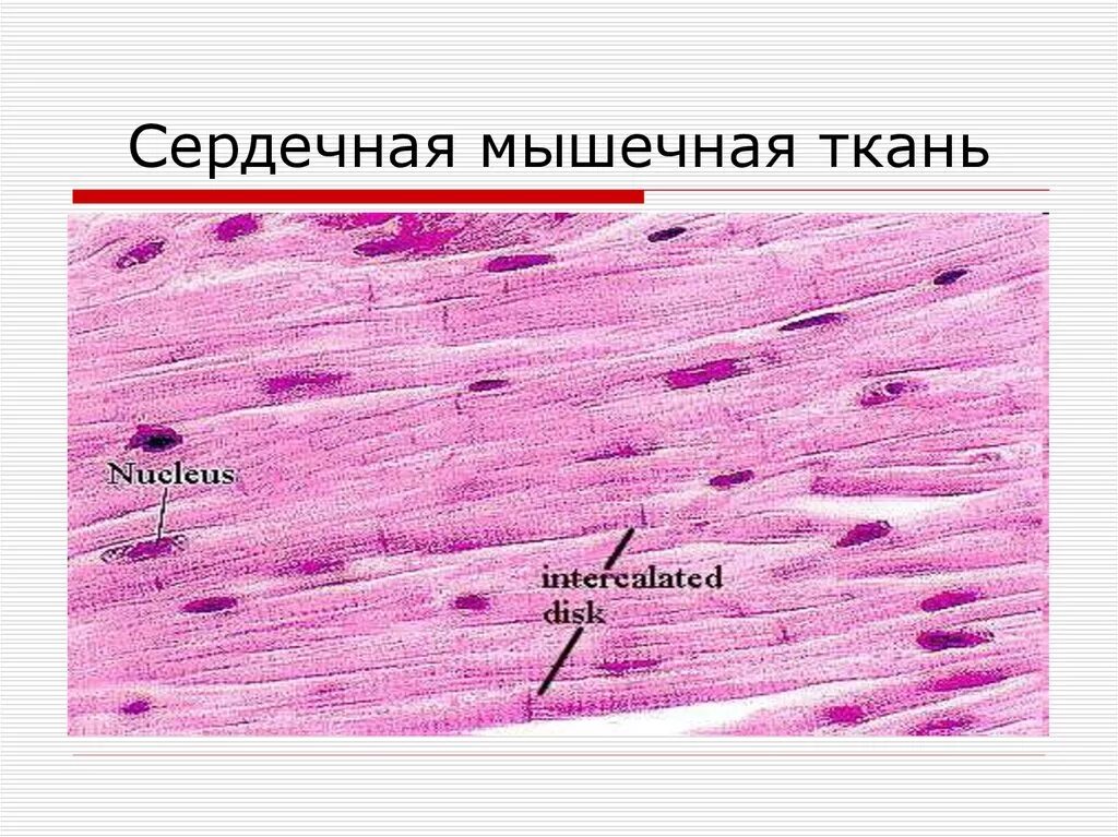 Поперечнополосатая сердечная мышечная ткань препарат. Поперечнополосатая сердечная мышечная ткань гистология. Поперечнополосатая сердечная мышечная ткань гистология препарат. Сердечная мышечная ткань гистология препарат. Сердечная мышечная ткань рисунок