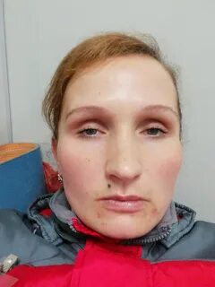 Немеет лицо и руки