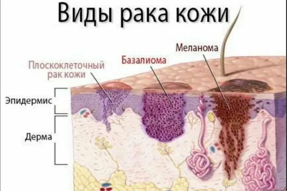 Солевой покров