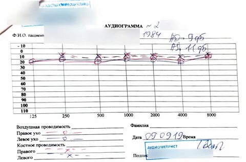 Аудиометрия слуха