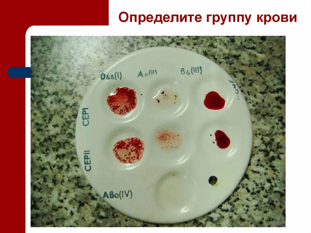 Как определить группу крови. Какузнаьь группу крови. Какмузнать группу крови. Какопрелелить группу крови.