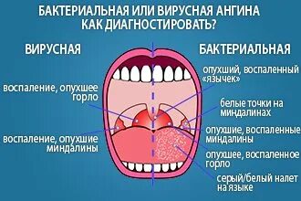 Как определить вирус или бактериальная