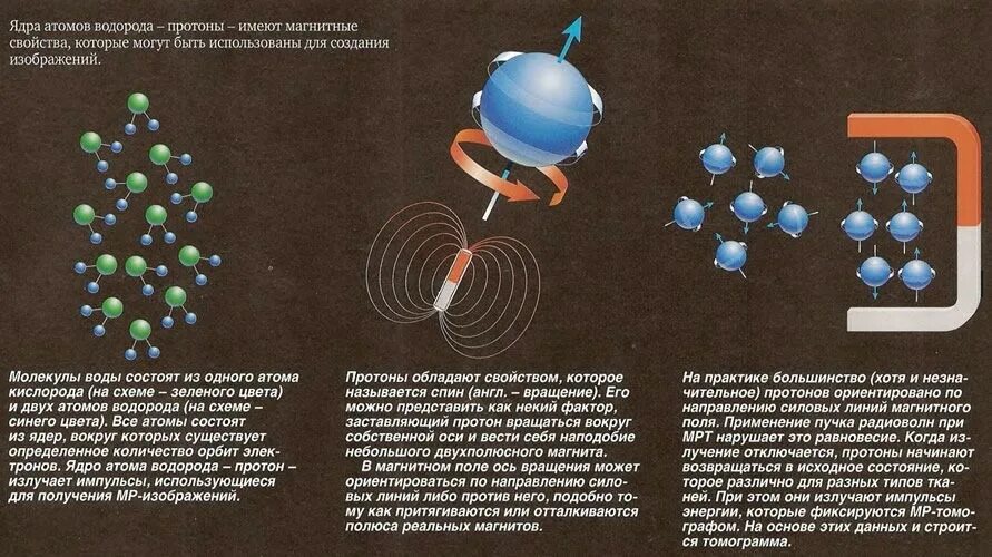 Изменилось ядро водорода. Принцип действия магнитно-резонансного томографа. Магнитно-резонансная томография принцип метода. Физические принципы магнитно-резонансной томографии. Физические основы мрт.