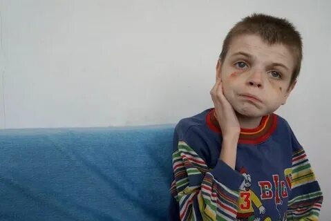 Родители детей с шизофренией