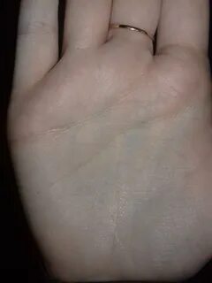 Почему ладони белые