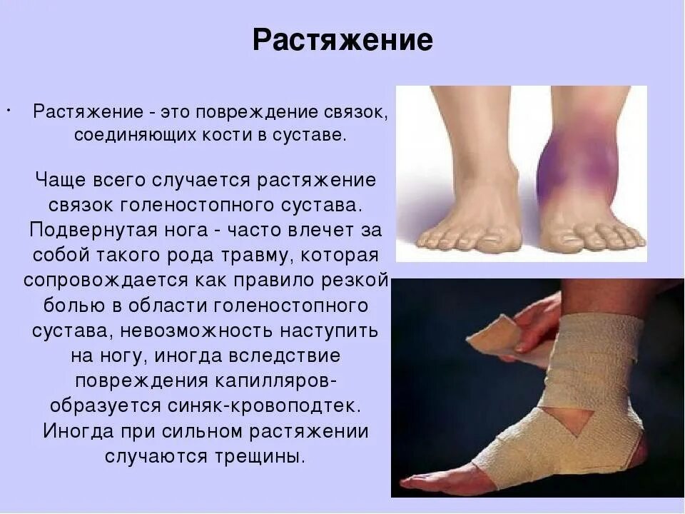 Растяжение голеностопного сустава лечение симптомы