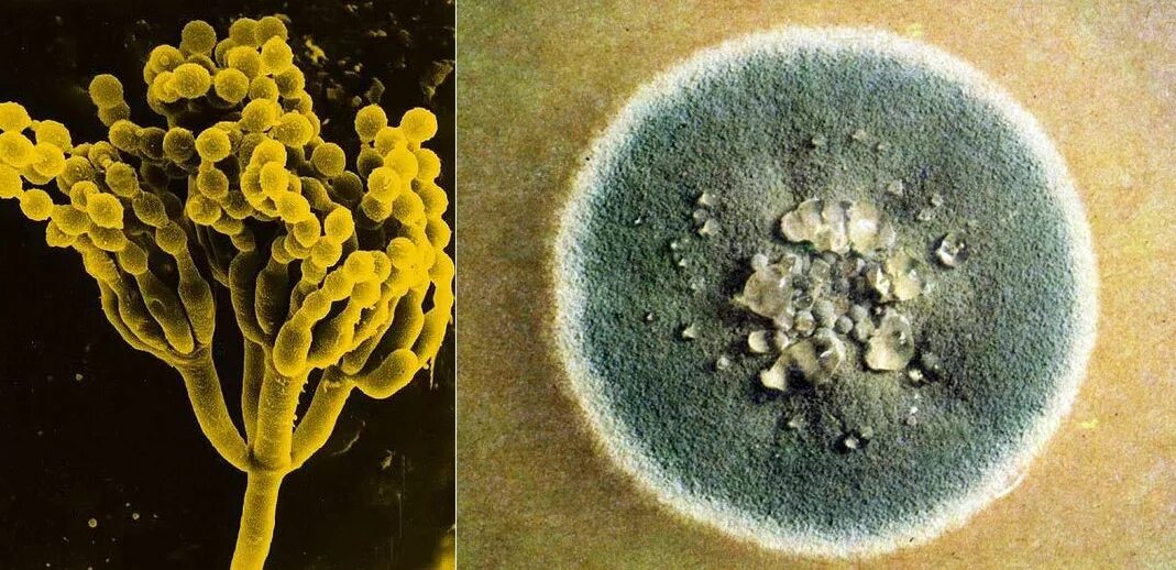 Гриб пеницилл плесень. Плесневые грибы пеницилл. Penicillium notatum пенициллин. Плесневелый гриб пеницилл. Плесневый гриб пенициллин