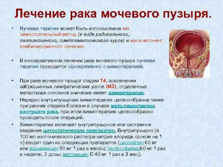 Стадии опухоли мочевого пузыря. Локализация опухоли мочевого пузыря. Опухоль мышечного слоя мочевого пузыря. Опухоль мочевого пузыря у мужчин.