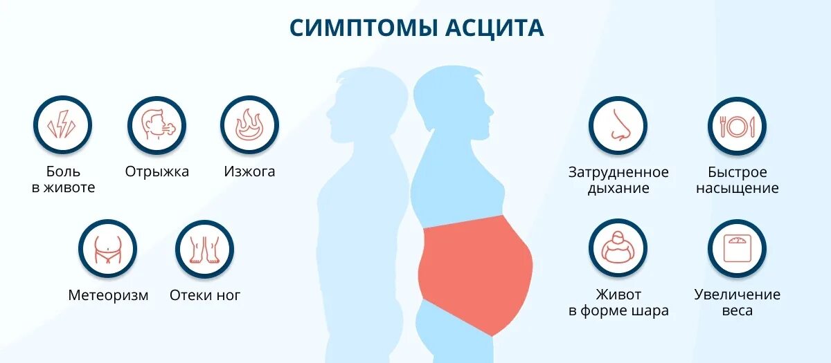 Признаки появившегося мужчины у женщины. Асцит клинические проявления. Жидкость в брюшной полости симптомы.