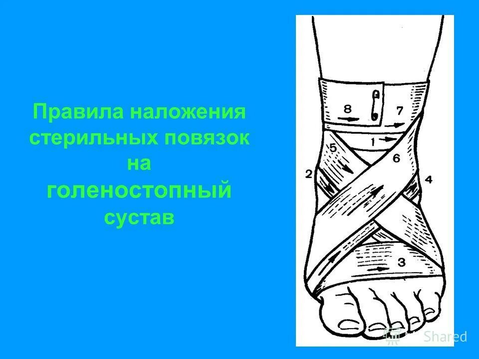 Технику наложения повязки на голеностопный сустав. Повязка восьмерка на голеностоп техника. Наложение повязки восьмиобразная. При повреждении голеностопного сустава применяется повязка. Восьмиобразная крестообразная повязка на голеностоп.
