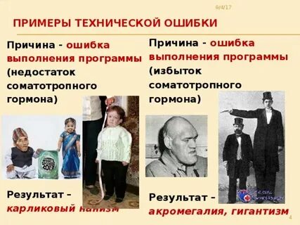 Акромегалия карликовость