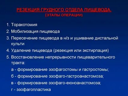 Торакотомия