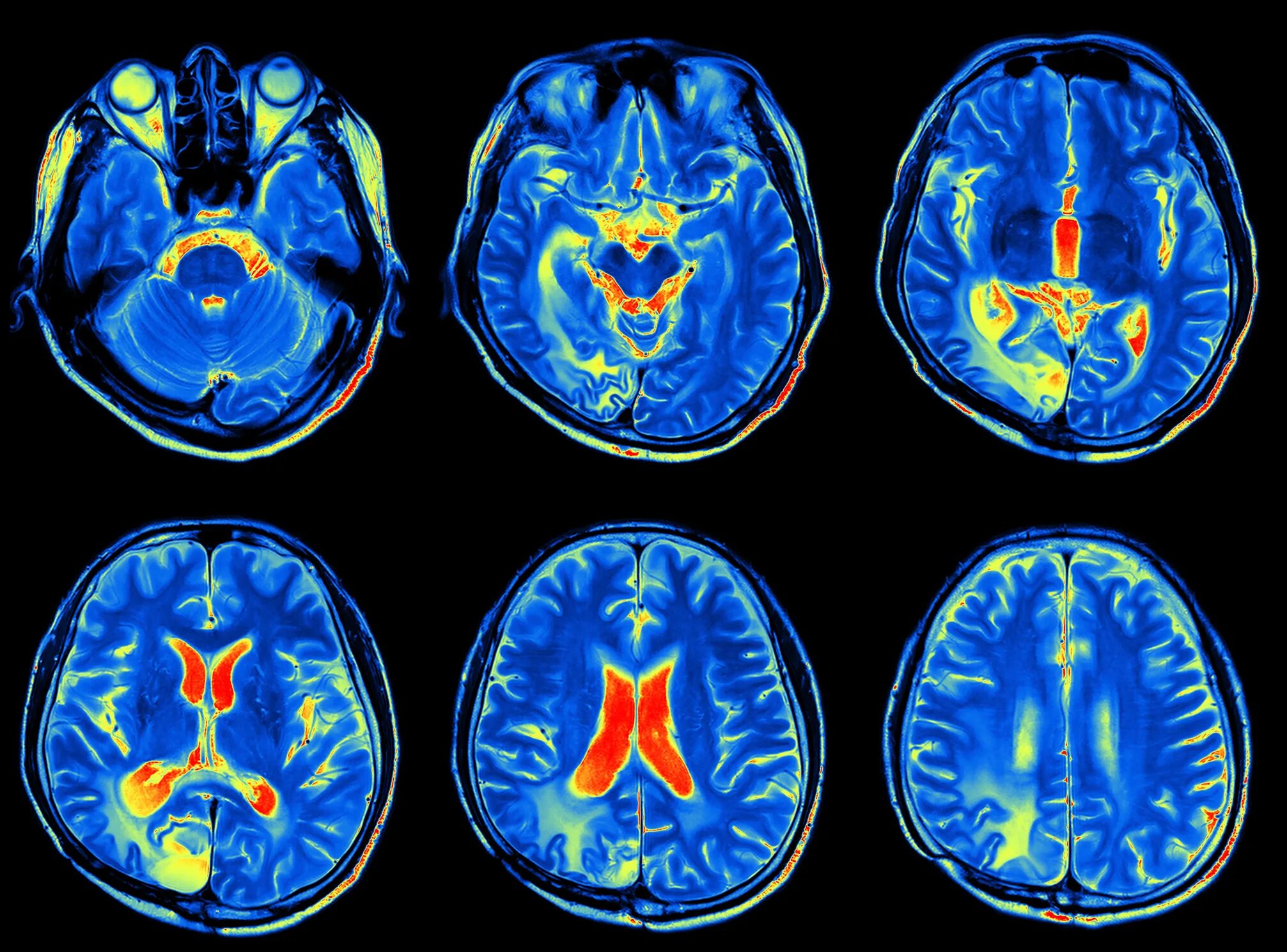 Магнитно резонансные томограммы головного мозга. Магнито-резонансная томография головного мозга. Мрт головного мозга. Что такое ЭМЭРТЭ головного мозга.