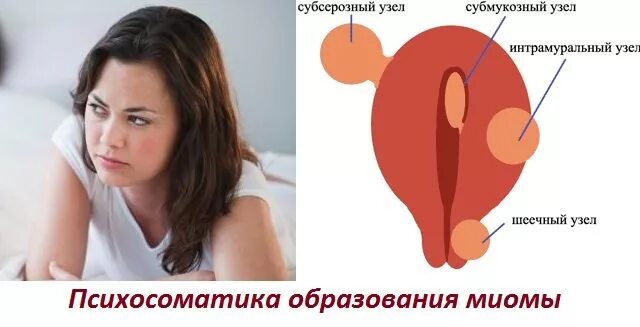 Рак матки психосоматика. Миома матки психосоматика причины. Психосоматика миомы матки у женщин. Психосоматика заболеваний матки. Психосоматика гинекологических заболеваний у женщин.