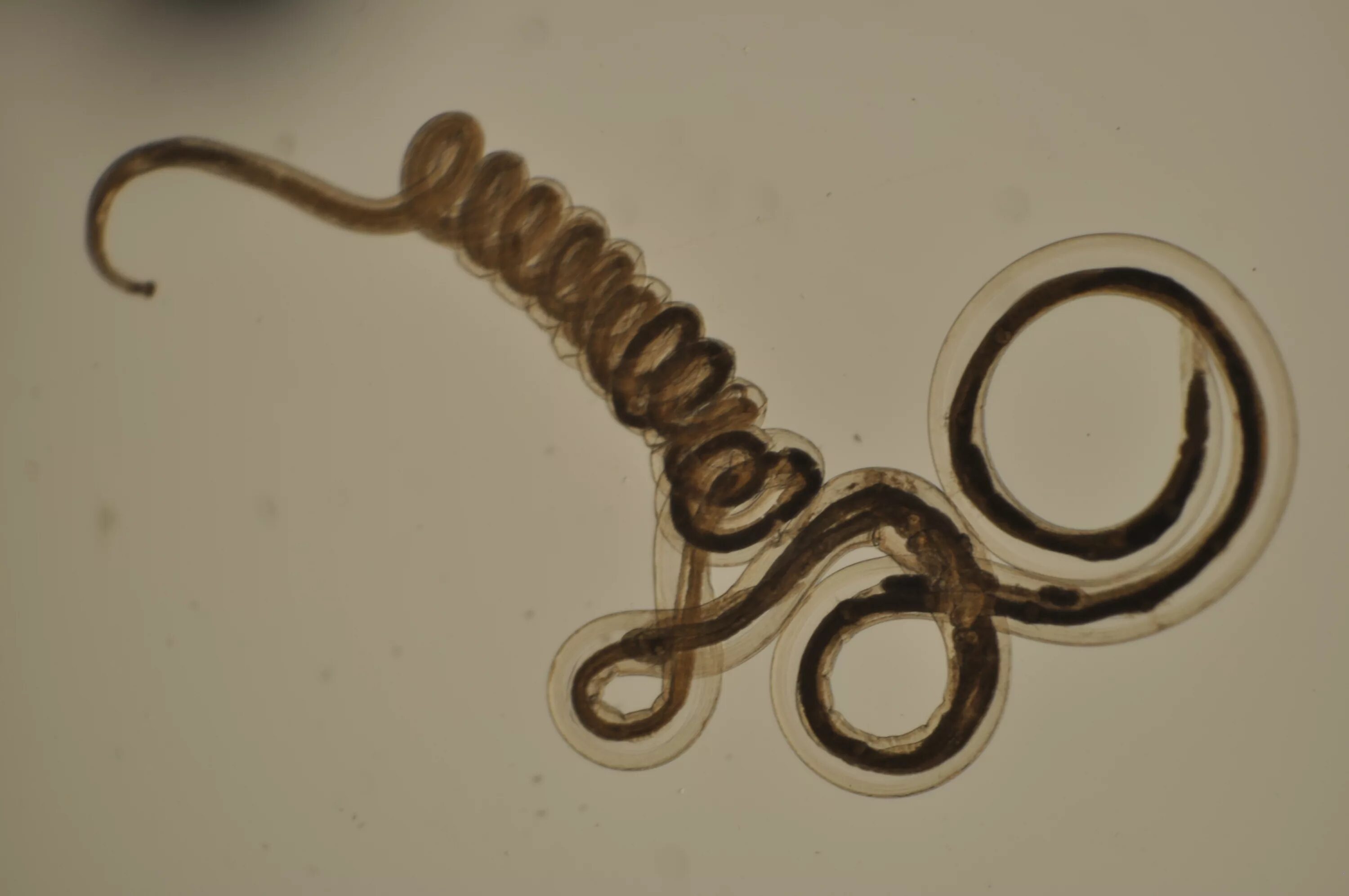 какие паразиты легких