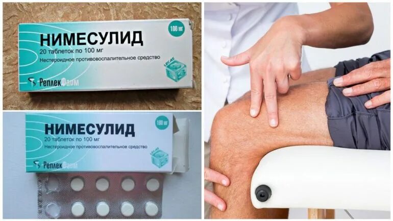 Обезболивающие препараты для суставов коленей. Лекарство противовоспалительное для суставов. противовоспалительные таблетки для суставов. таблетки для артроза коленного сустава. противовоспалительные препараты для коленного сустава.