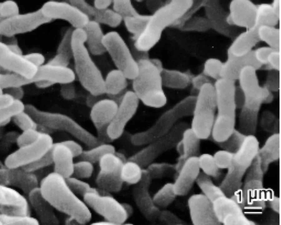 морфология пропионобактерий. пропионовокислые бактерии микроскопия. пропионовые бактерии акне. пропионовокислые бактерии. Propionibacterium freudenreichii subsp.