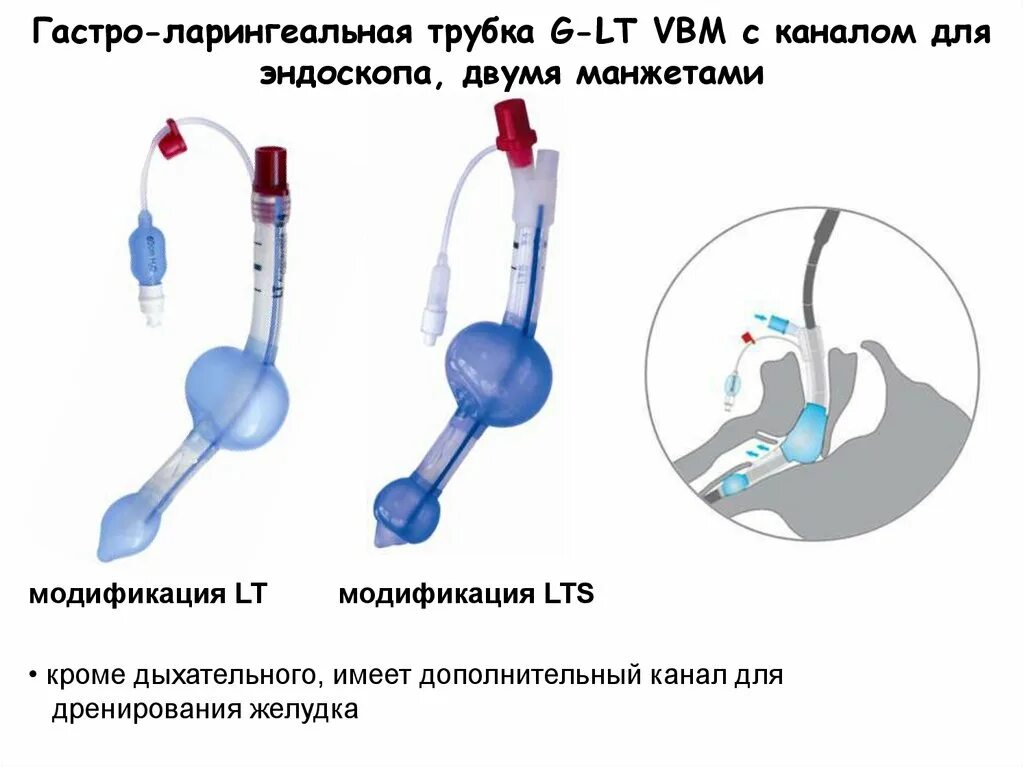 Ларингеальная трубка LTS II VBM 3205003. Ларингеальная трубка LTS-D. Ларингеальная трубка комбитьюб. Ларингеальная трубка 3.0. Размеры ларингеальных масок