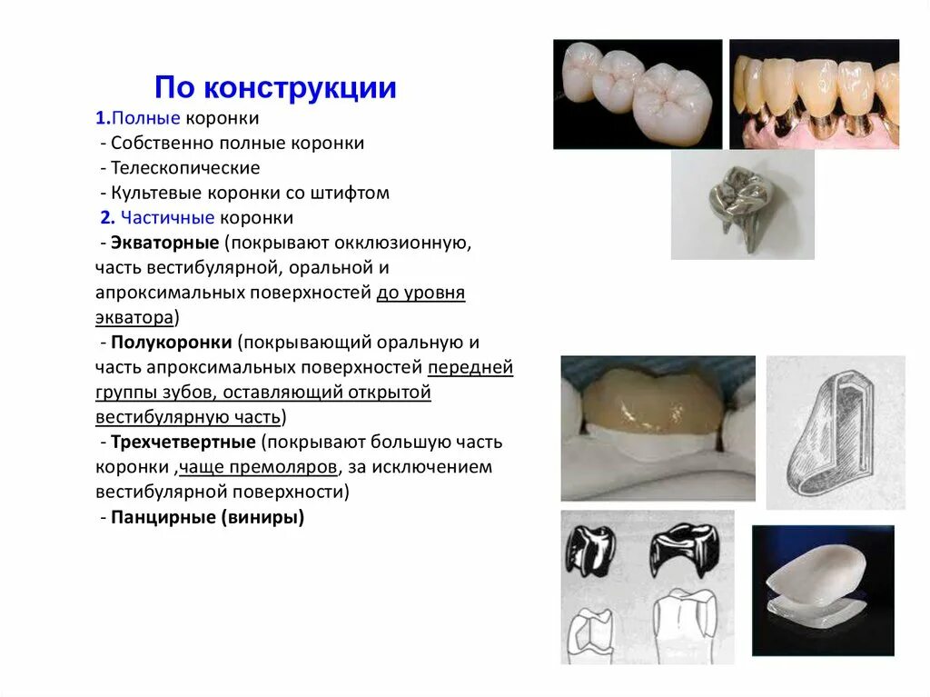 Почему не изготавливают цельнокерамических подошв. Классификация коронок по конструкции. Толщина литой металлической коронки. Экваторные искусственные коронки. Классификация искусственных коронок по конструкции.