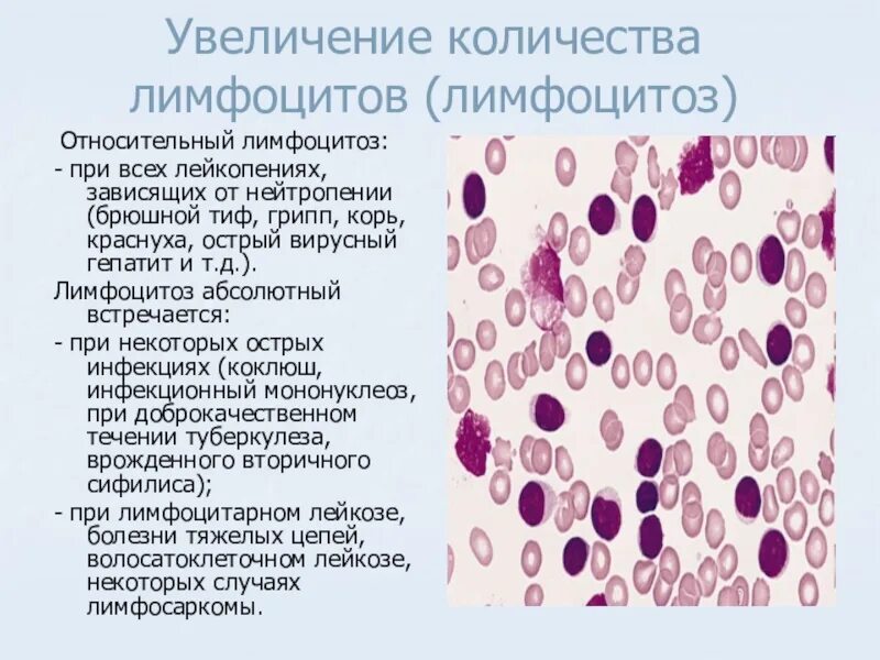 Лейкоцитоз нейтрофилы. В -лимфоциты хронический лимфолейкоз. Картина крови при лимфоцитозе. Картина крови при инфекционном лимфоцитозе. Повышен относительный лимфоцитоз.