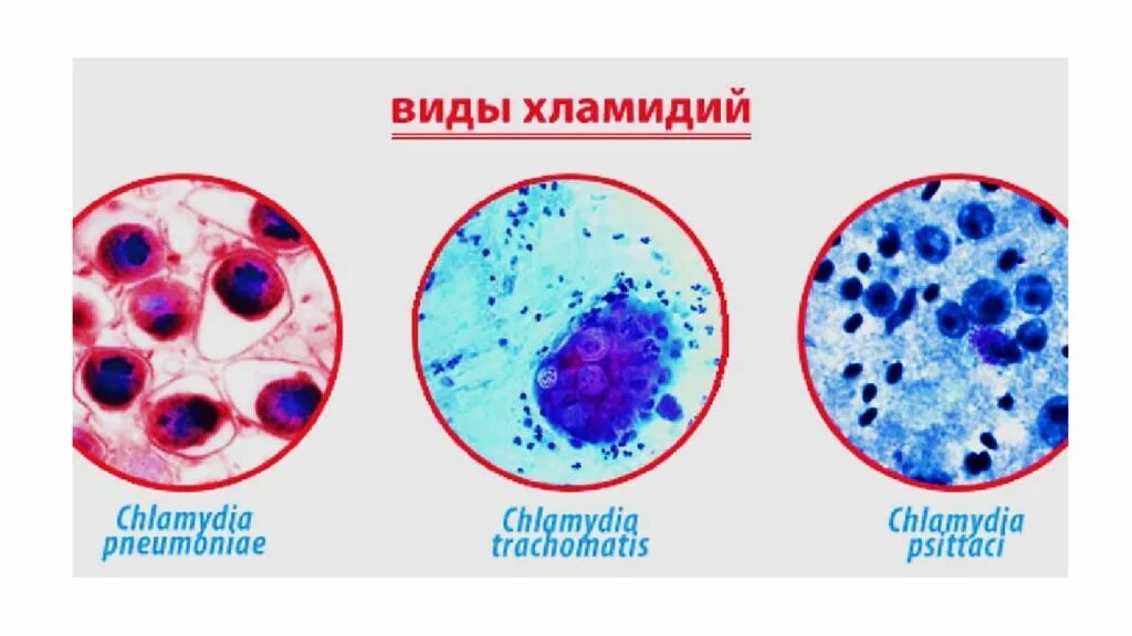 Живут хламидии. Хламидии форма бактерии. Хламидии trachomatis микробиология. Хламидии морфология микробиология. Хламидии микробиология заболевания.