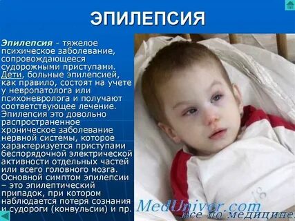Эпилептический синдром у детей