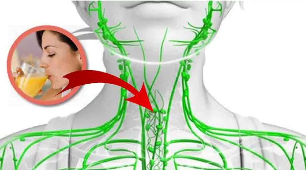 Чистка лимфосистемы. Для очистки лимфы. Застой лимфатической системы. Очищение лимфосистемы. Застоявшейся лимфы